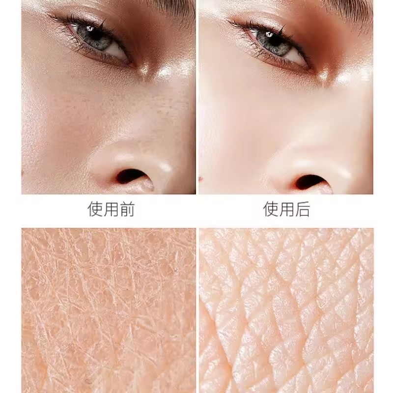 Niacinamide กรด Essence ดูแลผิ - Niacinamide Pore Shrinking Essence บทวิจารณ์และราคา