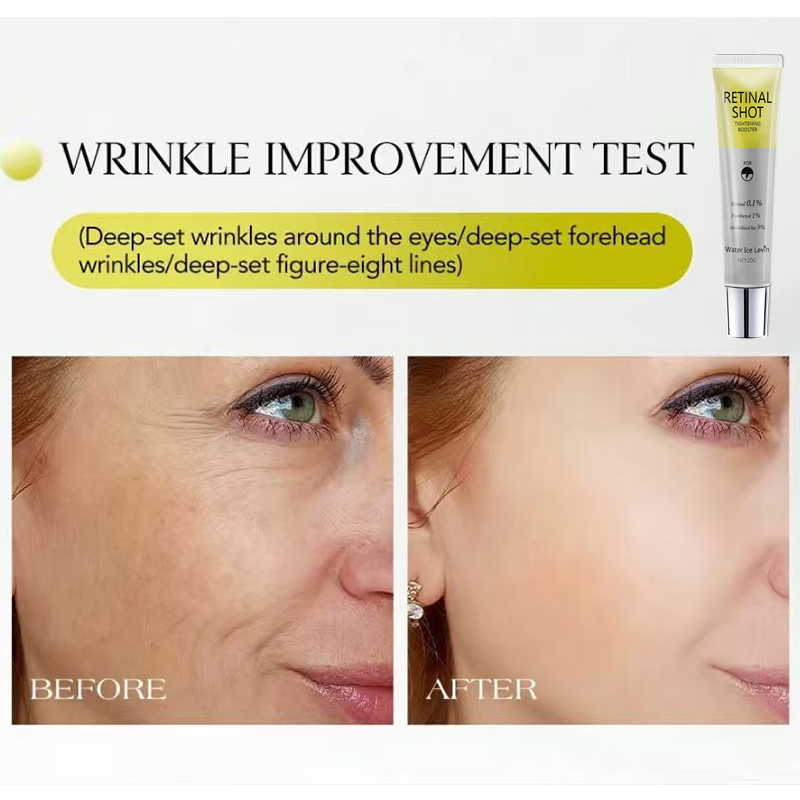เรตินอล 0.1% อินเทนซีฟ ช็อต แพ - Retinol Anti Wrinkle Cream บทวิจารณ์และราคา