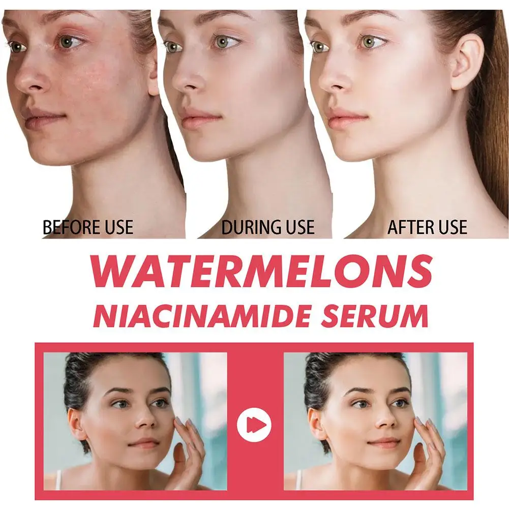 แตงโมเรืองแสง Niacinamide Mois - Hyaluronic Acid Facial Serum บทวิจารณ์และราคา
