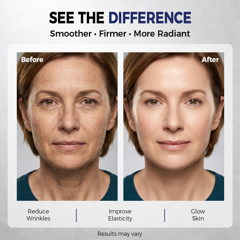 ครีมบำรุงผิวหน้าเรตินอลครีมลดร - Retinol Anti Wrinkle Cream บทวิจารณ์และราคา